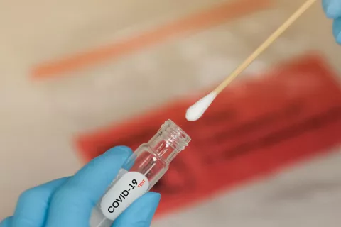 Sanidad toma el control de los test diagnósticos de centros privados Test diagnósticos de centros privados