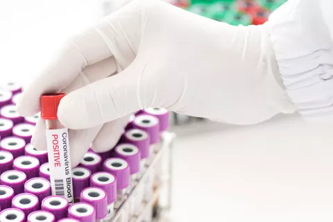 Grifols desarrolla un test de alta sensibilidad para el coronavirus Grifols desarrolla un test de alta sensibilidad para el COVID-19