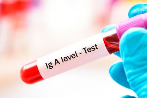 Test de anticuerpos: más eficaces a los 15-35 días de iniciar síntomas