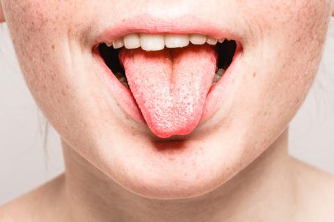 Los sarpullidos en la boca podrían ser un nuevo síntoma del coronavirus