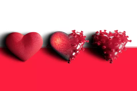 El impacto del COVID-19 sobre el corazón podría ser duradero El impacto del COVID-19 sobre el corazón