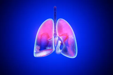 Pacientes con artritis pueden sufrir neumopatía intersticial Neumopatía intersticial