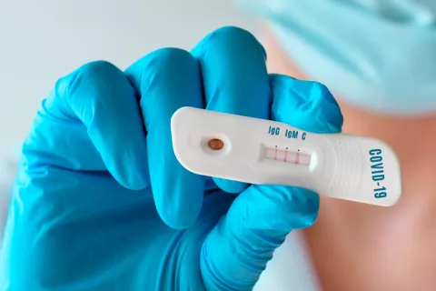 Los test rápidos que detectan COVID-19 en 15 minutos llegan a España Llegan a España los test rápidos que detectan COVID-19 en 15 minutos
