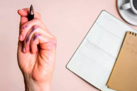 Hallan que ser zurdo depende de al menos 41 regiones de ADN Ser zurdo depende de al menos 41 regiones de ADN