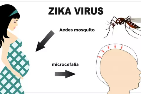 Identifican como el zika causa microcefalia al feto Mecanismo infección zika y microcefalia