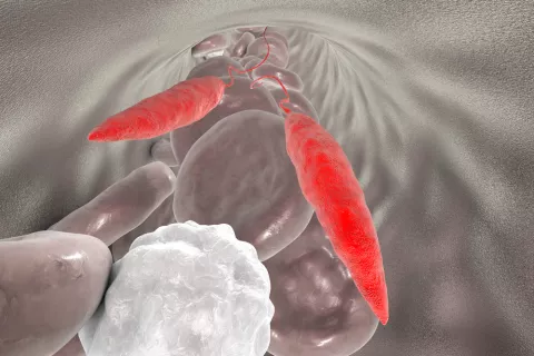 Hallan una diana potencial para crear vacunas contra la leishmaniasis Promastigotes del parásito Leishmania con glóbulos rojos y leucocitos