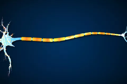 El reciclaje del colesterol repara la mielina en la esclerosis múltiple Colesterol y esclerosis múltiple