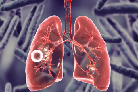 Una vacuna española contra la tuberculosis puede sustituir a la actual Vacuna Mtbvac eficaz contra tuberculosis