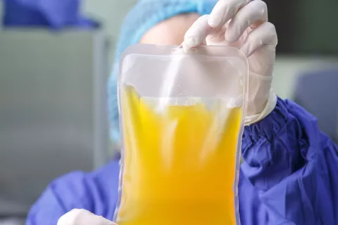El plasma sanguíneo de supervivientes reduce el riesgo de COVID grave Plasma sanguíneo evitaría COVID-19 grave