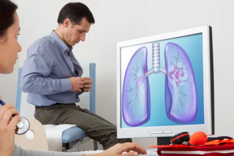 El cáncer de pulmón es el tumor más mortal en hombres en España El cáncer de pulmón es el mortal en hombres en España