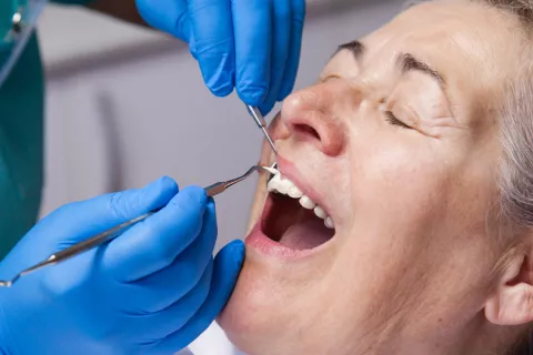 La periodontitis aumenta la gravedad del COVID-19 y el riesgo de morir Periodontitis y riesgo de COVID-19 grave