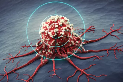 Primera terapia CAR-T para mieloma múltiple en aprobada por la FDA Terapia CAR T contra el mieloma múltiple