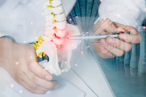 Una terapia evita la degeneración del disco que causa dolor de espalda Un doctor mostrando los discos intervertebrales