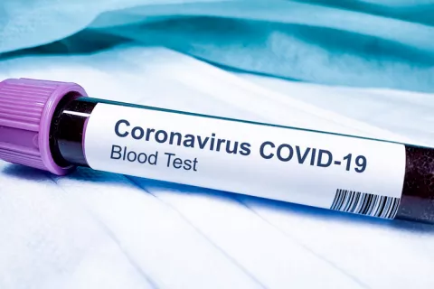 Un análisis de sangre podría predecir el desarrollo de COVID-19 grave Tubo con muestra de sangre