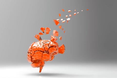 Alzhéimer: así avanza en el cerebro 