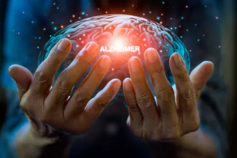 Nuevo enfoque prometedor para un tratamiento y vacuna del alzhéimer Alzhéimer: posible vacuna y tratamiento