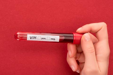 2º paciente elimina VIH sin tratamiento
