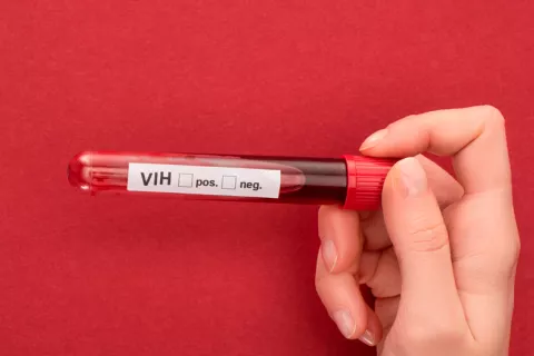 Un segundo paciente con VIH habría eliminado el virus de su cuerpo 2º paciente elimina VIH sin tratamiento