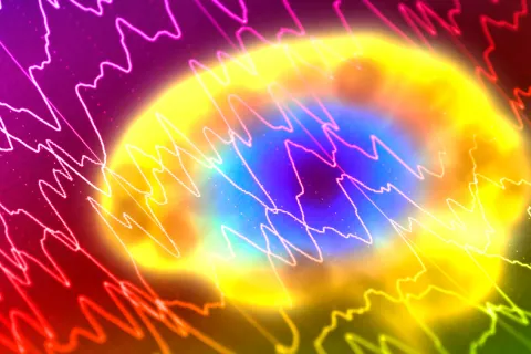 Ictus como causa de epilepsia en adultos Accidente cerebrovacular causa de epilepsia