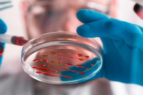 Científico trabaja con platos de Petri con muestras de sangre.