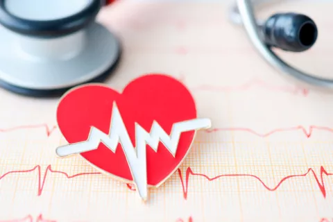 Hallan nuevos factores de riesgo genéticos para una arritmia cardiaca Arritmias: importante hallazgo genético