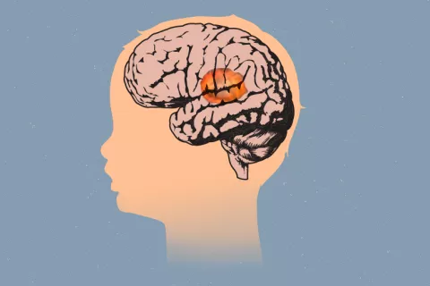 El tumor cerebral infantil más letal podría ser tratable con un virus Virus vence un tumor infantil letal