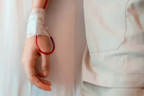 Intercambio de sangre, prometedora terapia para el alzhéimer Diálisis de sangre en un paciente mayor