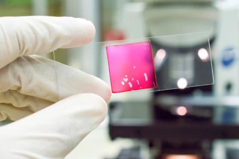 Técnica de biopsia líquida detecta cáncer en sangre