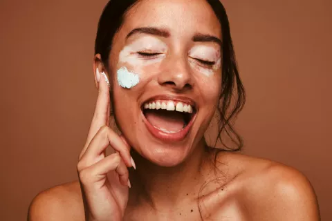 Crema para el vitíligo mejora drásticamente la decoloración de la piel Vitíligo: crema mejora la repigmentación