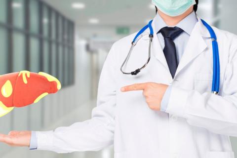 Doctor mostrando una ilustración de un hígado con acumulaciones de grasa