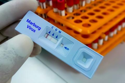 Test positivo por virus de Marburg