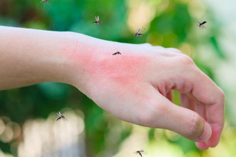 Mosquitos picando en la mano a una persona