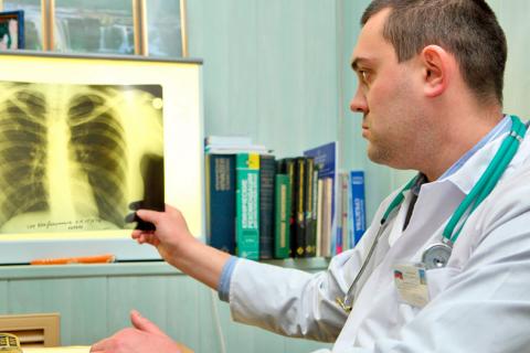 Un médico observando una radiografía de pulmón