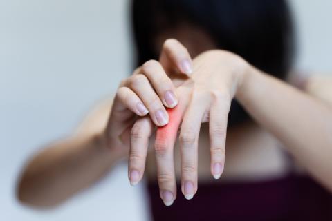 Mujer se toca mano izquierda donde tiene dolor por osteoartritis
