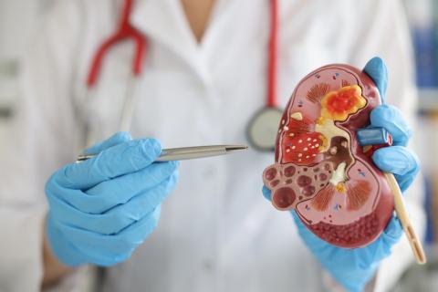 Un médico muestra un modelo anatómico de un riñón