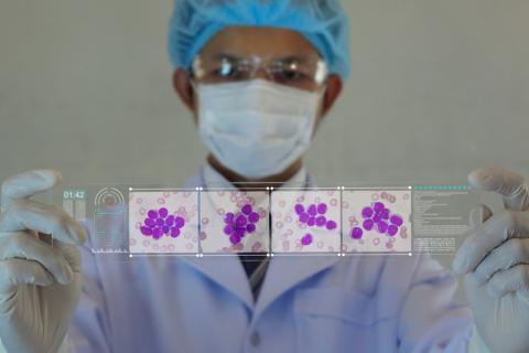 Científico buscando células afectadas por leucemia