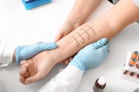 Un brazo con marcas pintadas para hacer un test de alergias