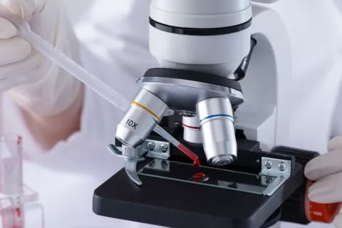 Descubren un código de barras en la sangre que revela cómo envejecemos Científico analiza una muestra de sangre bajo el microscopio