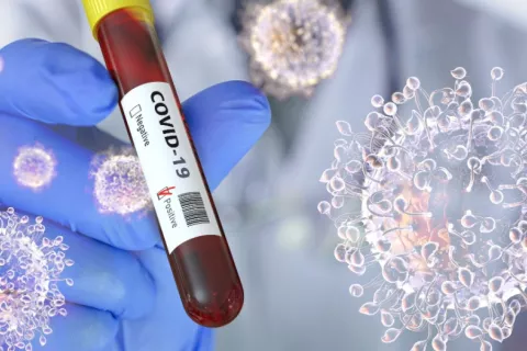 Muestra de sangre infectada por el coronavirus SARS-CoV-2 Sanitario sostiene un tubo de ensayo con sangre y la etiqueta que indica positivo al COVID