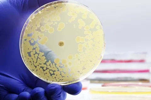 Investigador sujeta un cultivo microbiológico de Petri con bacterias y prueba de resistencia a antibióticos