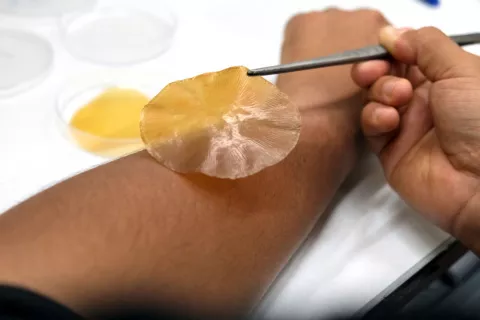 Nuevo apósito desarrollado por el CSIC frena infecciones bacterianas Apósito creado por el CSIC para frenar infecciones sobre el brazo de una persona