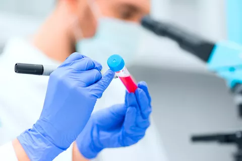 Doctores analizando una muestra