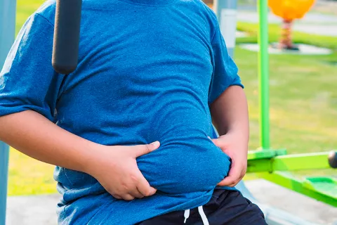 Obesidad infantil Obesidad infantil