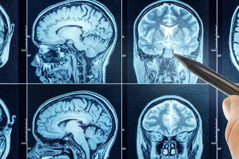 Cómo gestiona la información el cerebro Escáner de un cerebro