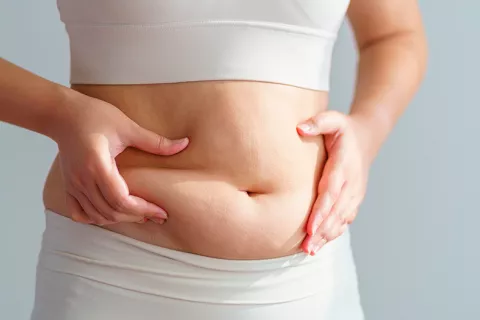 Efecto rebote tras perder peso al tratarse con Ozempic Mujer sujetándose el abdomen con kilos de más recuperados