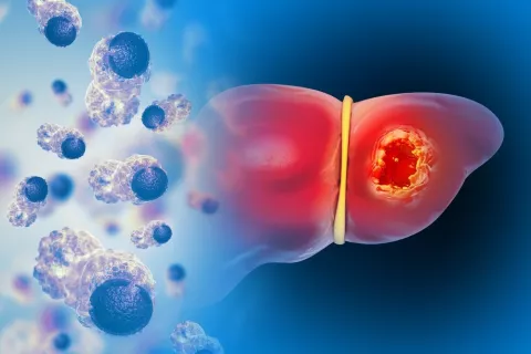 Imagen de un hígado en 3d siendo atacado por células cancerosas