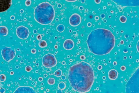 Células cancerosas, investigan para provocar su autodestrucción Células cancerosas