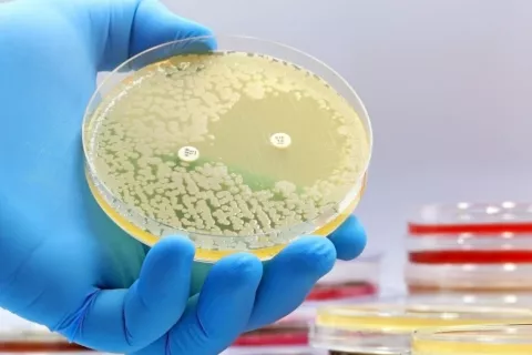 Cultivo microbiológico de Petri con bacterias para hacer prueba de resistencia a antibióticos