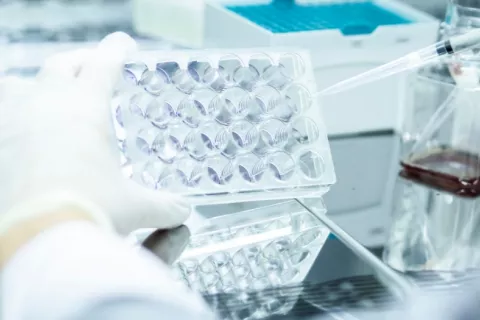 Análisis de cultivo celular en laboratorio Científico en laboratorio analiza un cultivo celular