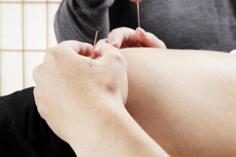 La acupuntura ayuda al inicio espontáneo del parto